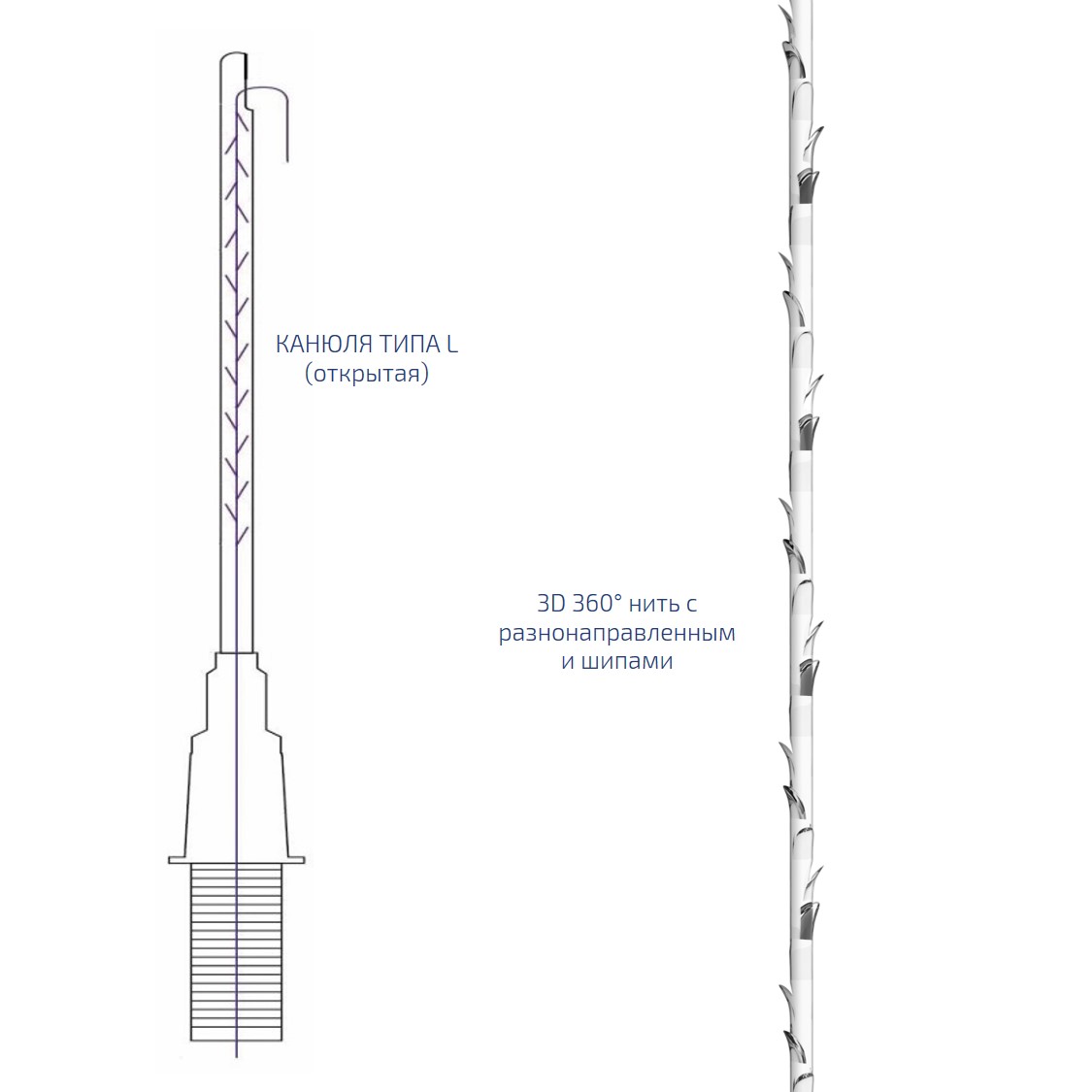 Нить из полимолочной кислоты шипованная на L-образной канюле FE/ Cog Pro III (Cannula L type)PLLA УП