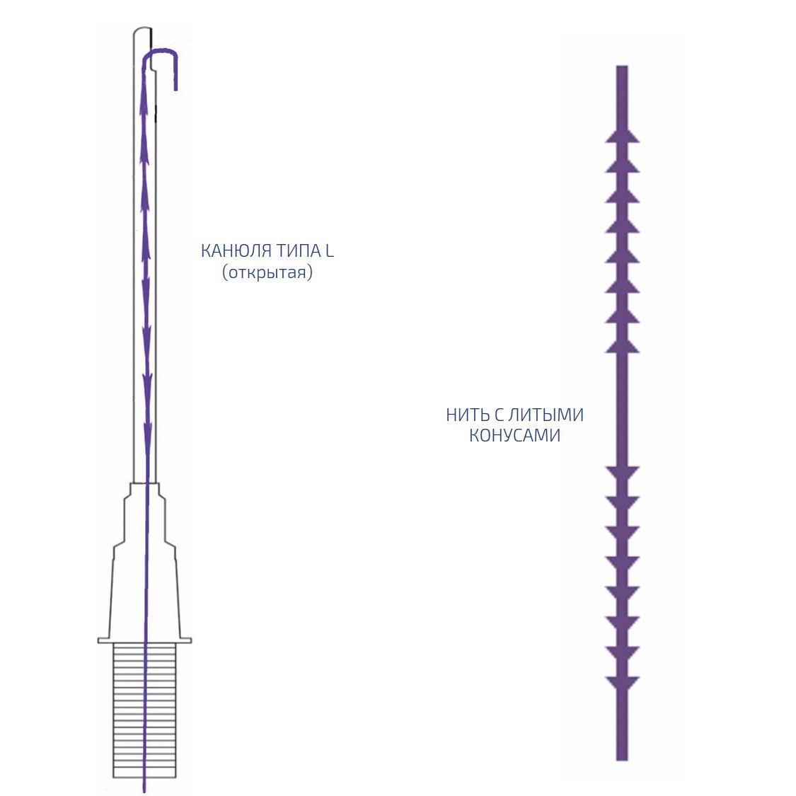 Нить из полидиоксанона шипованная на L-образной канюле SC / Cog Master Gear 1(Cannula L type)PDO УП